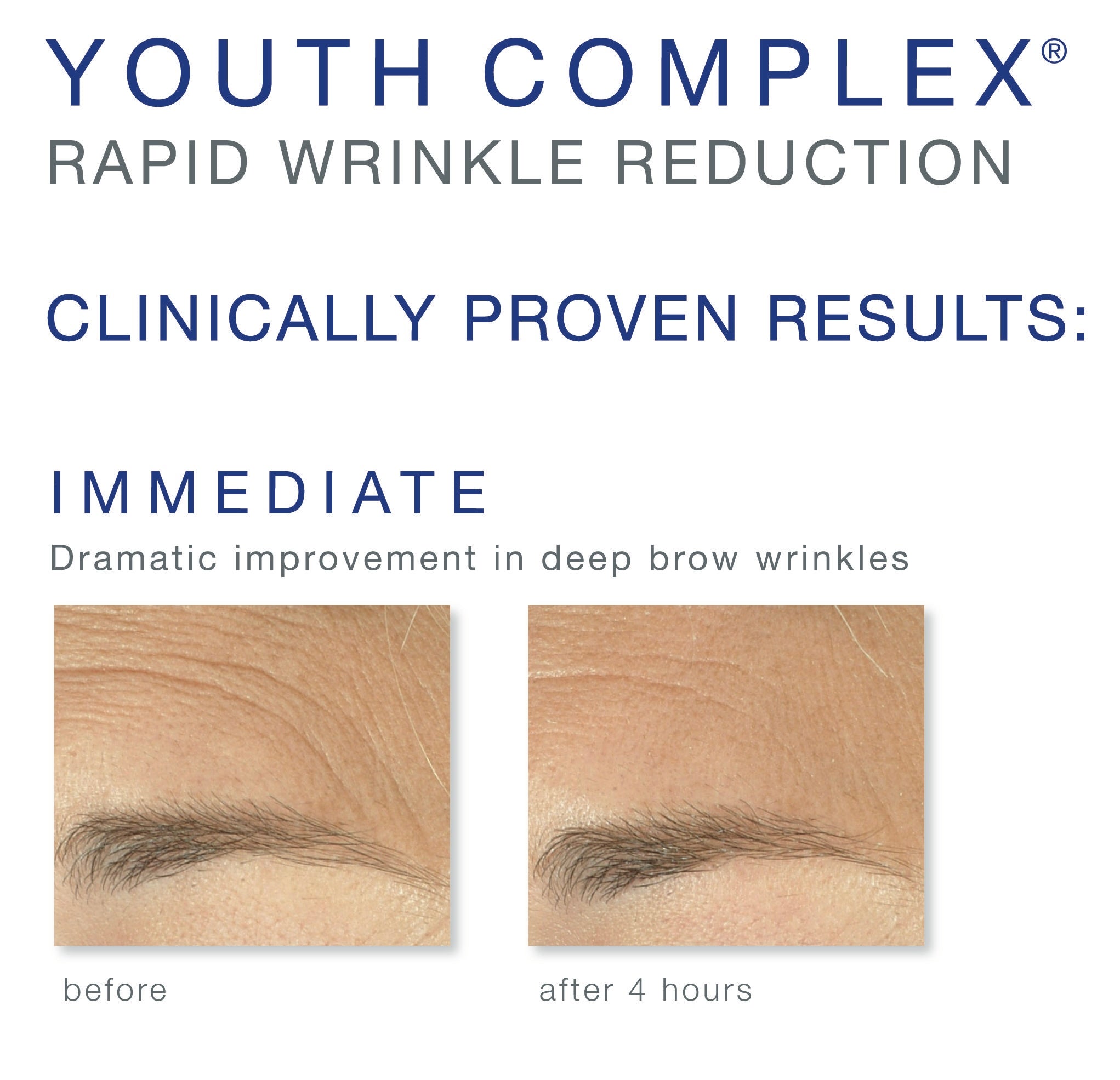 Ennen ja jälkeen kuva youth complex