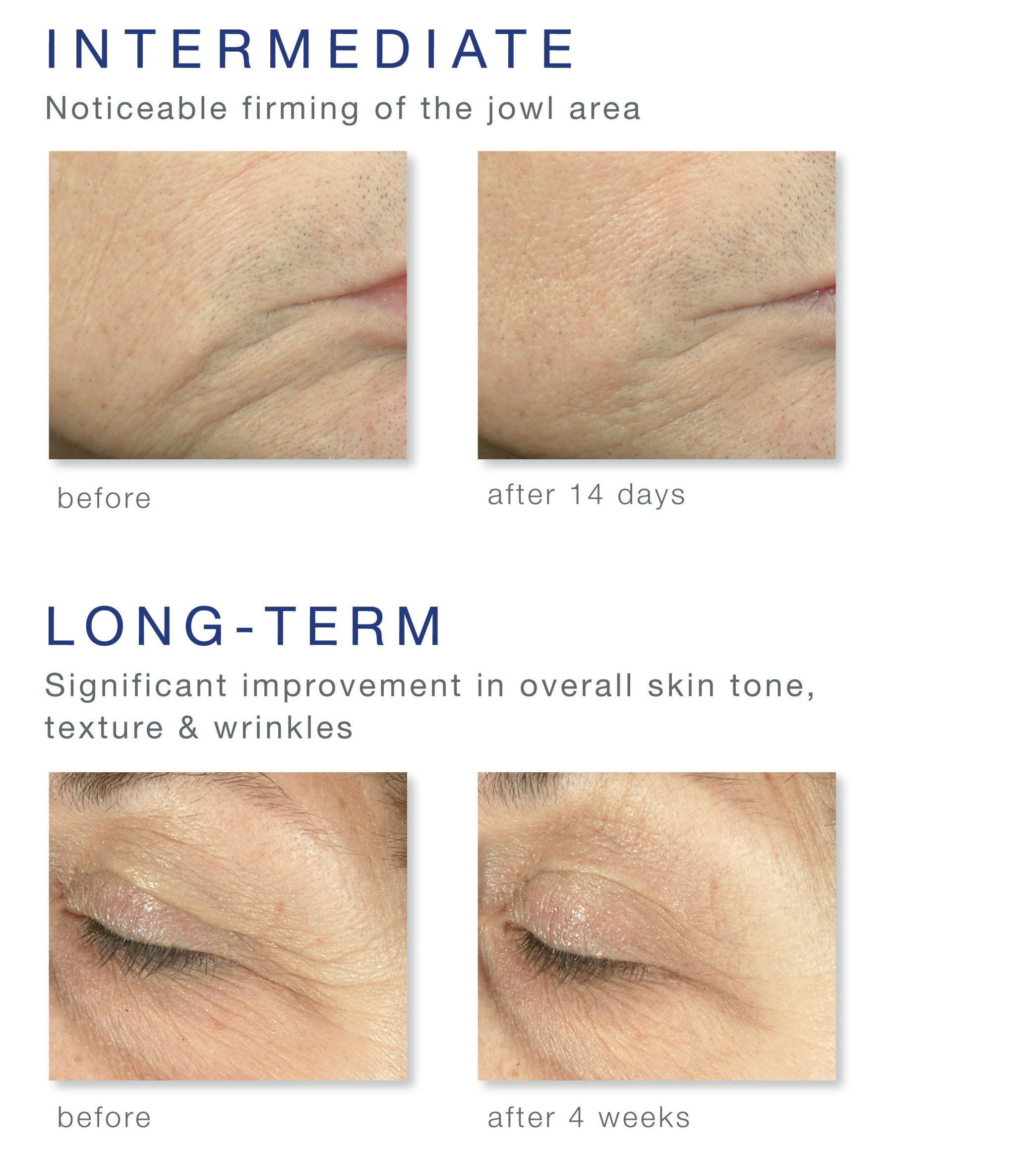 Ennen ja jälkeen kuva youth complex